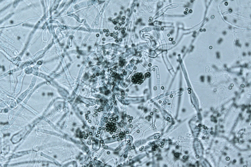 Trichodermas bajo el microscopio.